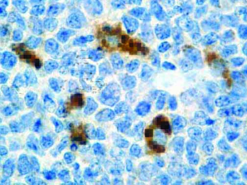 Alpha-1-Antichymotrypsin – Rabbit Polyclonal