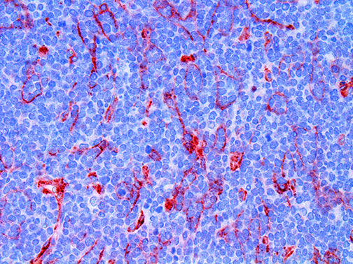 B7H3 / CD276 – RMab
