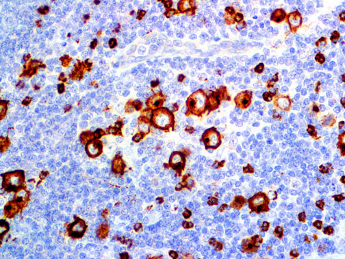 CD15 – MMab