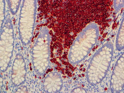 CD19 – MMab