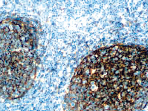 CD21 – RMab