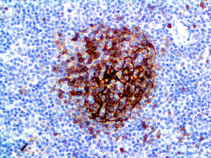 CD23 – RMab