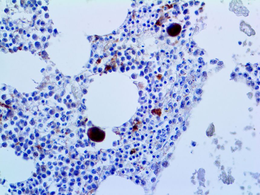 CD25 – RMab