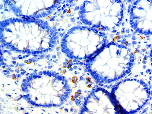 CD33 – RMab