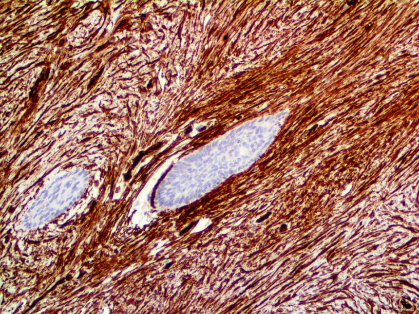 CD34 – RMab