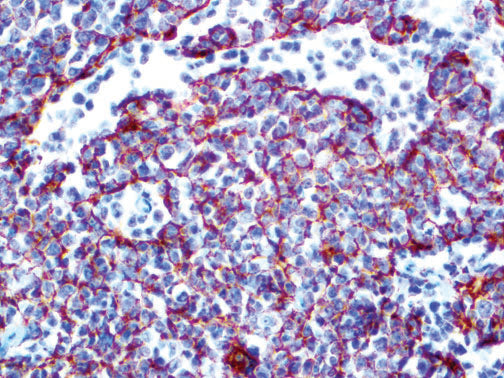 CD35 – MMab