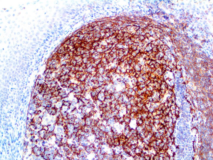 CD35 – RMab