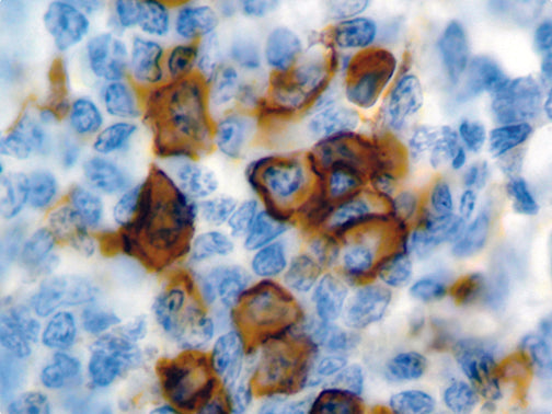CD38 – MMab