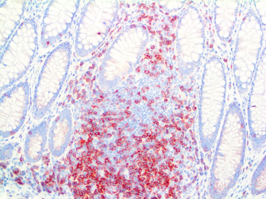 CD3 Epsilon – RMab