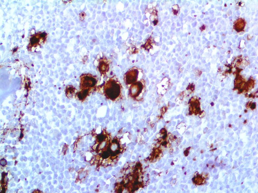 CD41/Integrin alpha IIb – RMab