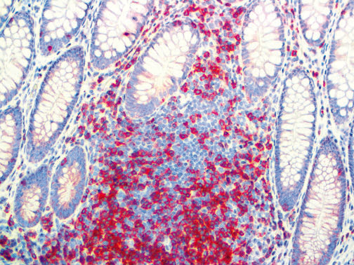 CD45RO – MMab