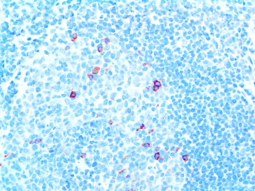 CD57 – MMab