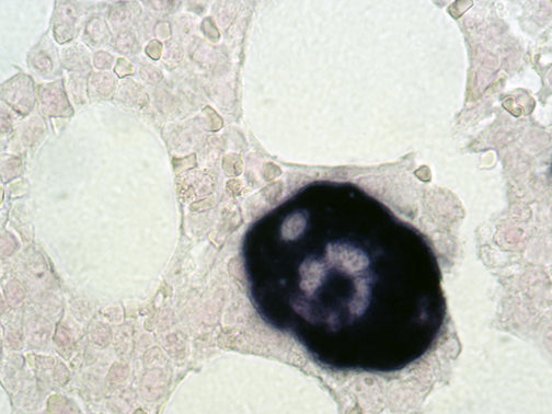 CD61 – MMab