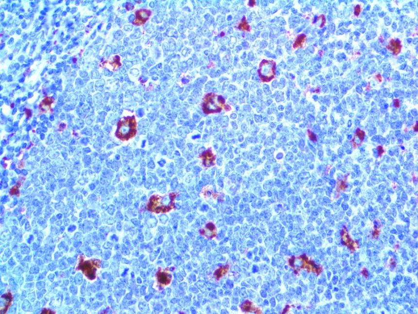 CD68 – MMab