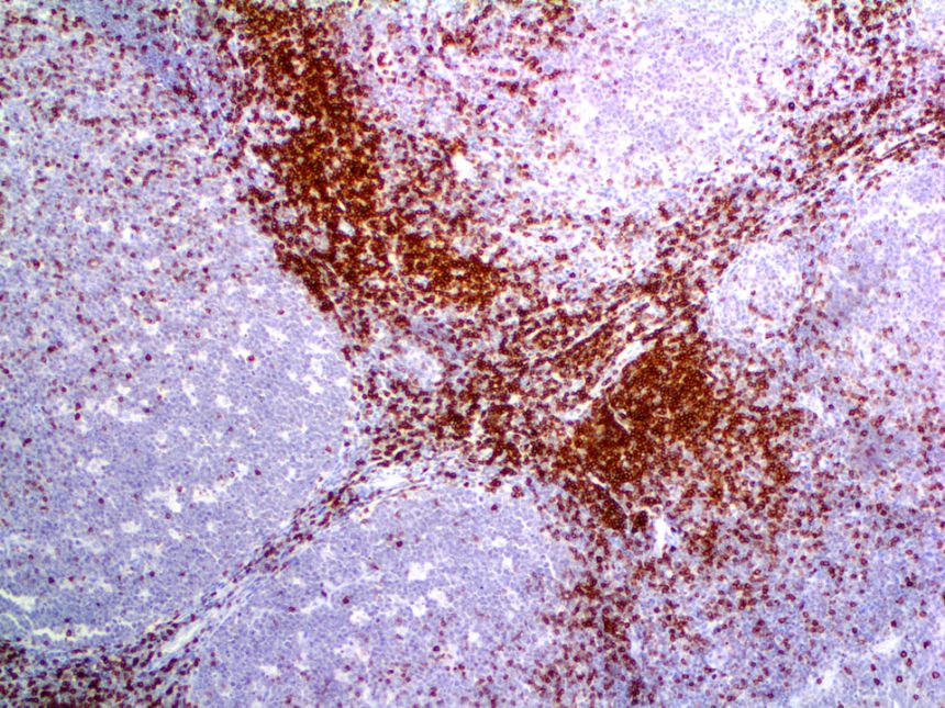 CD7 – RMab