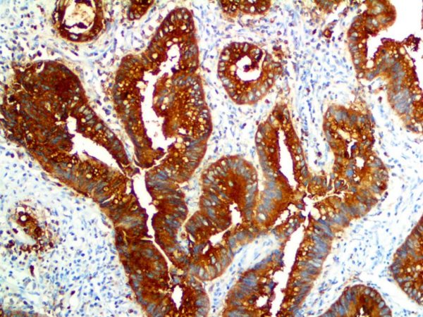 CEA – Rabbit Polyclonal