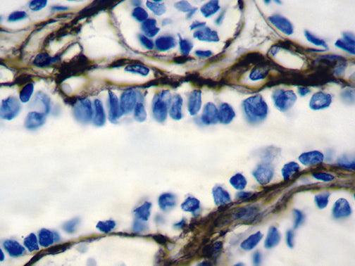 Collagen Type IV – MMab