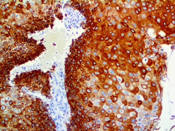 Cytokeratin 17 – MMab