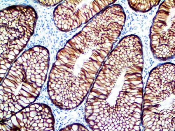 Cytokeratin 18 – RMab