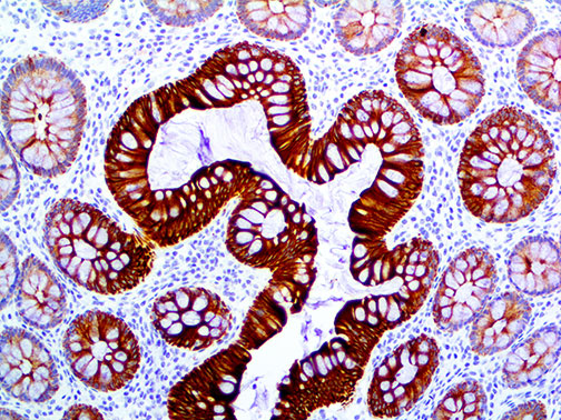 Cytokeratin 19 – RMab