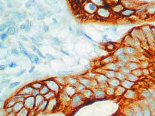 Cytokeratin 20 – MMab