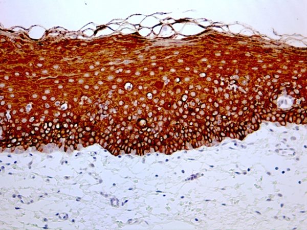 Cytokeratin 4 – RMab