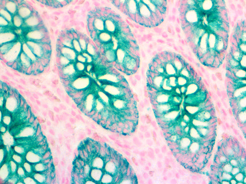Cytokeratin Oscar – MMab