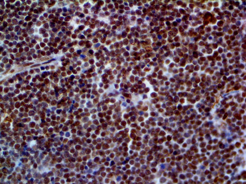 ERCC1 – RMab