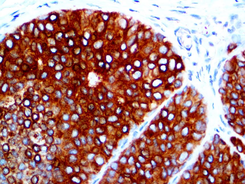 EpCAM/Epithelial Specific Antigen (MOC-31) – MMab