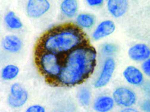 Epstein Barr Virus – MMab