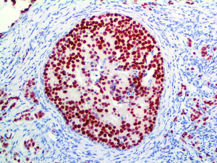 Estrogen Receptor Alpha – RMab