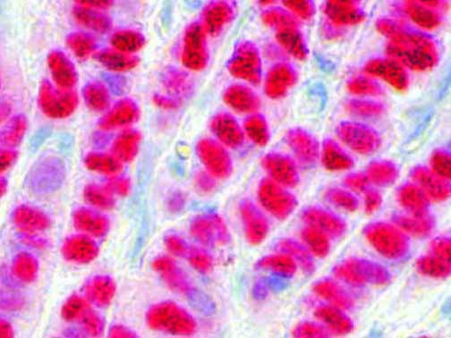 Estrogen Receptor – RMab