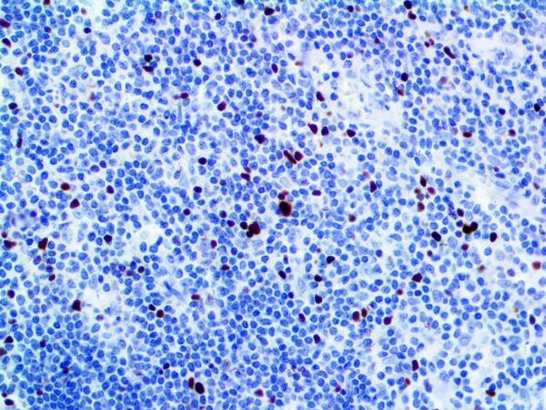 FOXP3 – Rabbit Polyclonal