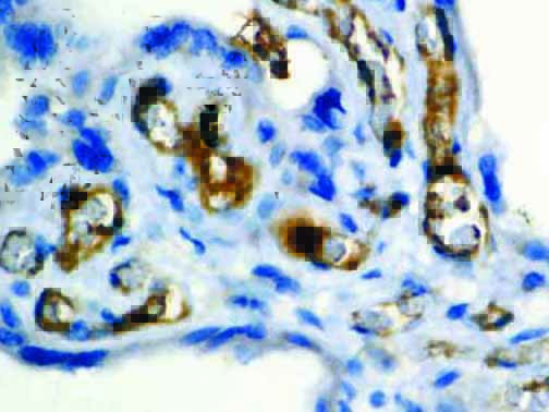 Factor VIII Related Antigen – Rabbit Polyclonal