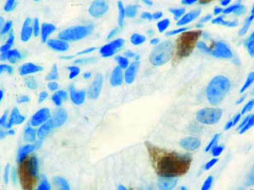 Gastrin – Rabbit Polyclonal