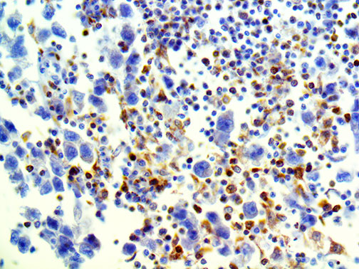 LAG-3 / CD223 – RMab