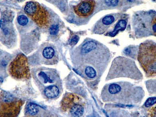 Luteinizing Hormone (LH) – MMab