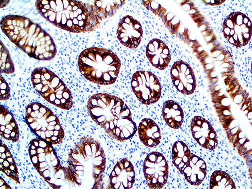 MUC4 – MMab