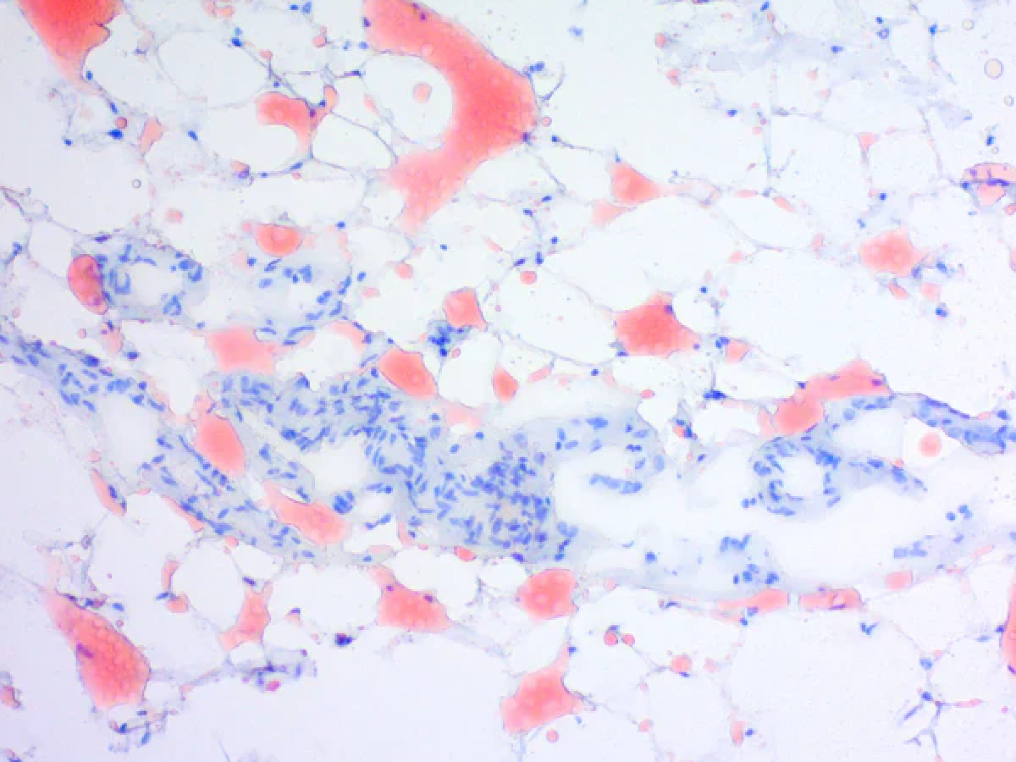 Oil Red O Stain Kit (For Fat)