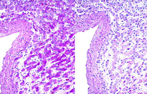 Periodic Acid Schiff (PAS) Diastase Stain Kit