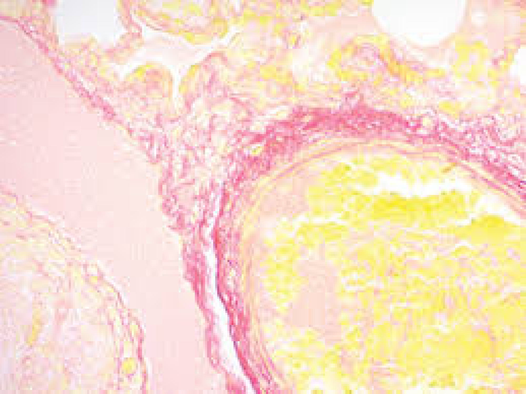 Picro-Sirius Red Stain Kit (For Cardiac Muscle)