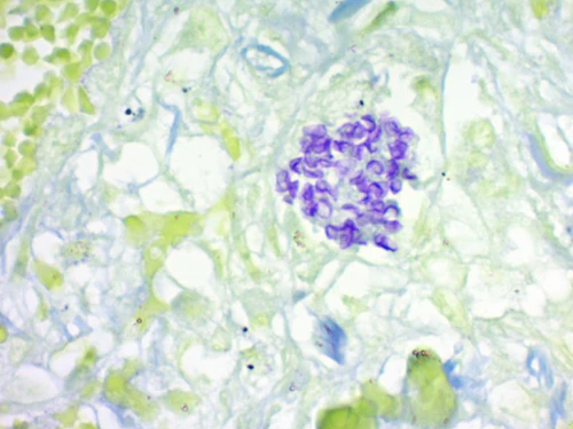 Pneumocystis Stain Kit