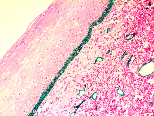 Podoplanin/D2-40 – MMab