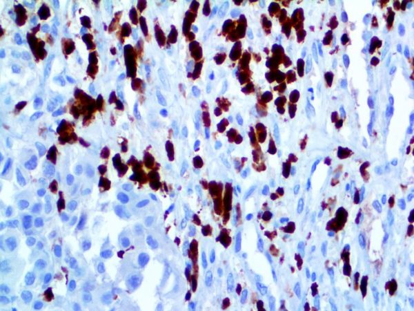 S100P – RMab