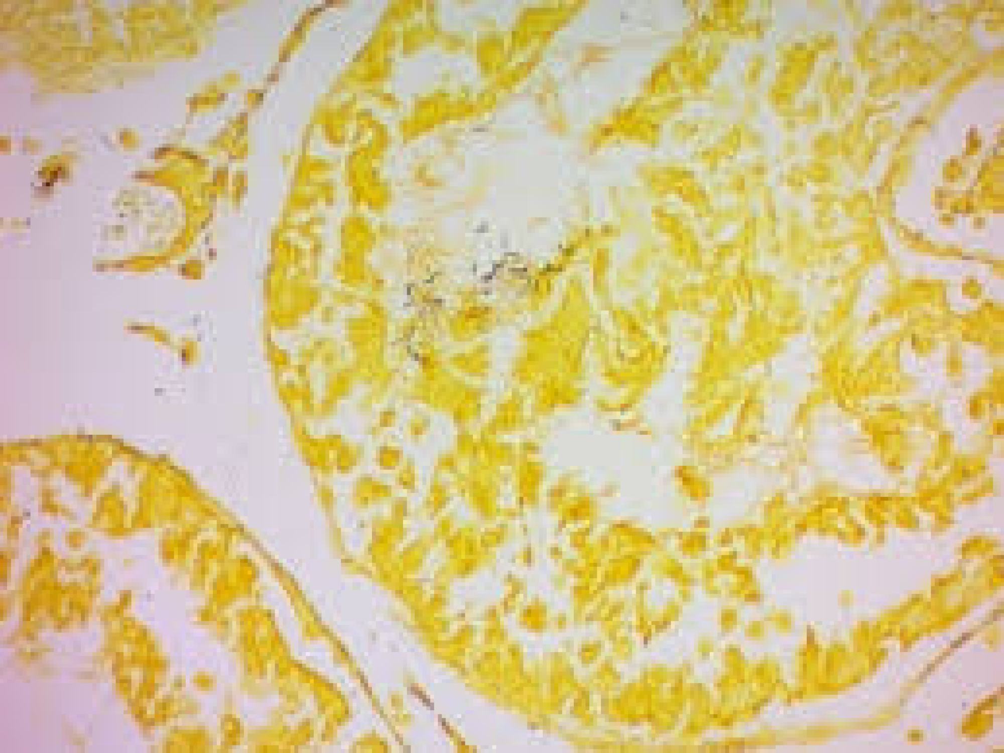 Steiner Stain Kit (For Spirochetes)