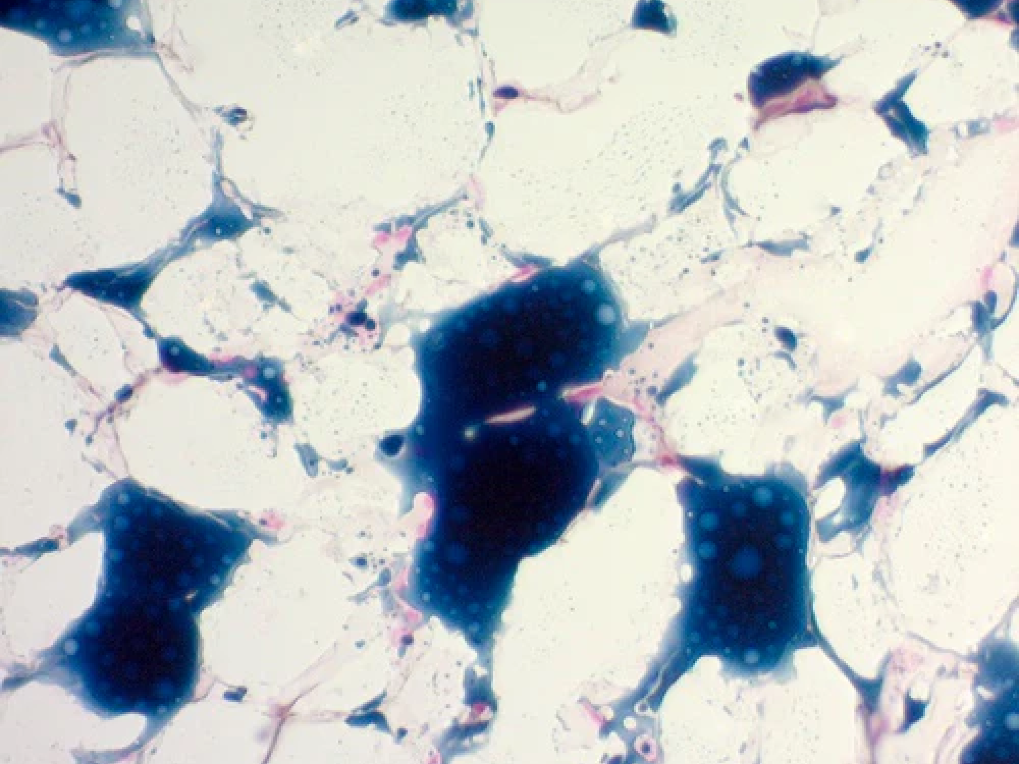 Sudan Black B Stain Kit (For Fat)