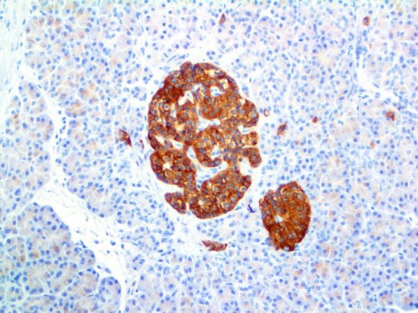 Synaptophysin – RMab