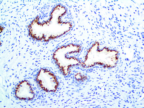 Prostein/P501S – RMab