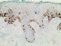 TintoFast Melanoma Cocktail (HMB-45, A103 & BSB-6), MMab