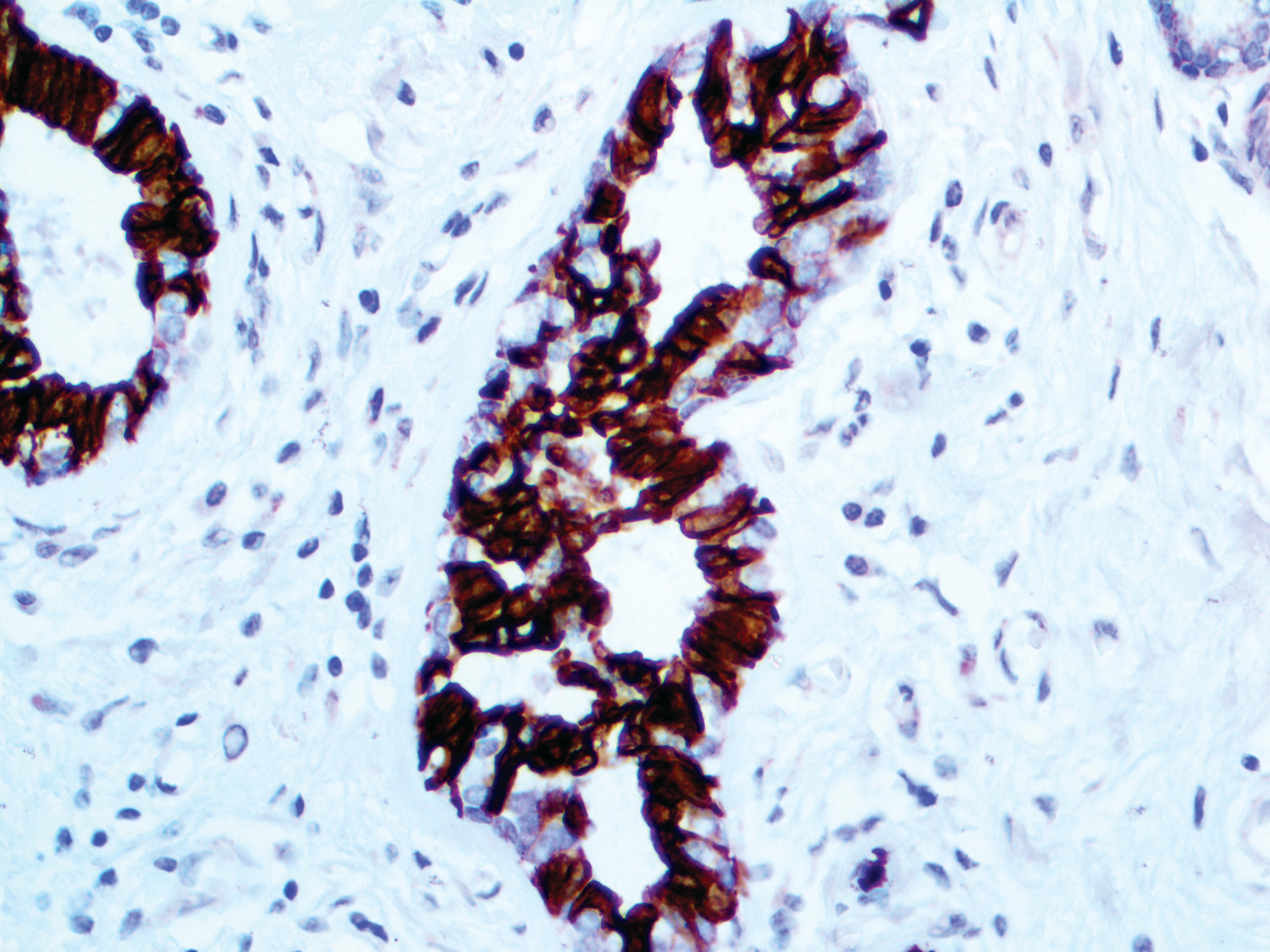 Bax – RMab